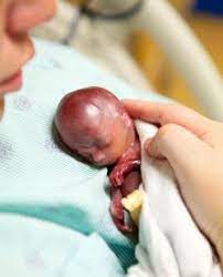 Las almendras son buenas para adelgazar. Amor Eterno Video Madre Y Bebe De 19 Semanas Conmueven Al Mundo Lo Abrace Mientras Su Corazon Latia
