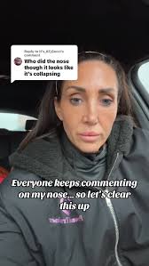 So apparently my nose is everyone’s business lately 😂, No TKC Health  Services haven’t done my nose…YET!!!, I am planning Rhinoplasty with them  though, and I’ve been planning it for a long time. After ...