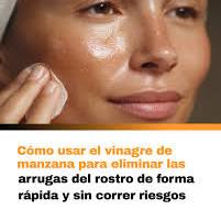 Su aplicación tópica, cuando se realiza correctamente, puede ...