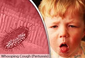 4 ﻿ with a fever, you may also experience chills or shaking. Respiratory Illnesses 13 Types Of Lung Infections