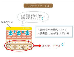 3ヶ月で治る顔の脂漏性皮膚炎 アトピー攻略ブログ 脂漏性皮膚炎 皮膚炎 治る