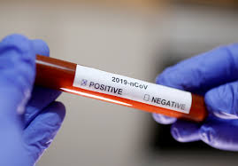 Public health officials are warning americans to brace for the spread of the coronavirus, and many are wondering about the best way to prepare — and whether they have enough money to get tested and. 5 To 15 Cured Covid 19 Cases Will Test Positive Again Chinadaily Com Cn