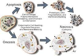 This necrosis occurs with equal effectiveness in cells with or without functional apoptosis. Cell Death And Cancer Novel Therapeutic Strategies Intechopen