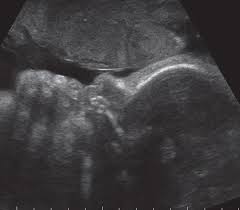 Das große buch für babys erstes jahr: Wachstumstabelle Der Fotus In Der Schwangerschaft