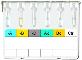 50µl of reagent red cells to be pipetted in to the labeled microtubes of matrixtm ahg (coombs) test card followed by 25µl patient's serum or plasma. China Abo Rhd Blood Typing Card Microcolumn Gel Immunoassay China Testing Forward