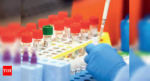 Covid 19 Assam Trying To Deliver Swab Test Reports Within 48 Hours Guwahati News Times Of India