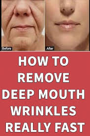 Donna Manzo (dmanzo0460)