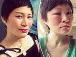 MasterChef's Poh Ling Yeow looks unrecognisable after bee sting