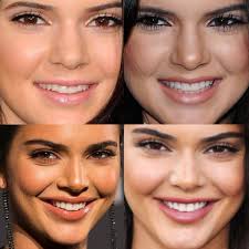 Before and after with images. Kendall Smile Differences Through The Years Kuwtk