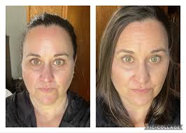 Learning contouring open for corrections