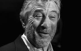 Here S The Name Of Every Wrinkle On Your Face Face Wrinkles Face Wrinkle