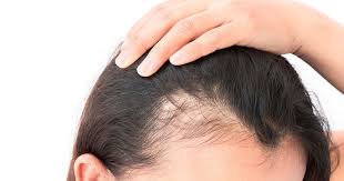 It can often cause irritation and itching in the scalp skin. Itchy Scalp Itchy Scalp Treatment Itchy Scalp Reasons