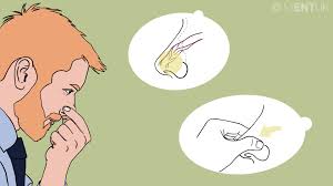 Image result for Epistaxis