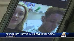 Cincinnati man severely burned in apartment explosion near Ohio University