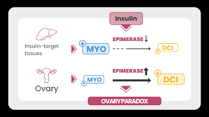 The Difference Between Inositol Myo Inositol And D Chiro Inositol Inositoli It