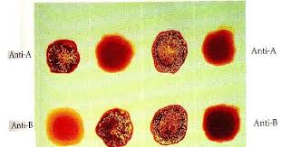 Maybe you would like to learn more about one of these? Karakteristik Golongan Darah Manusia Pusat Bio Pendidikan