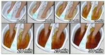 La Desintoxicación Iónica a través de los pies | nomasvarices