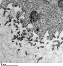 Check spelling or type a new query. Researchers Show How Ebola Virus Hijacks Host Eurekalert