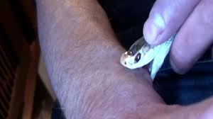 Image result for Snake Bite