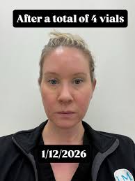 Sip. Save. Sculpt. ✨ Join us for an exclusive Sculptra mini consultation  event with Sara Carney, DNP. 📍 Bel Air, MD 🗓️ 1/14 ⏰ 4:00