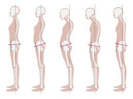 2,800+ Posture Evaluation Stock Photos ...