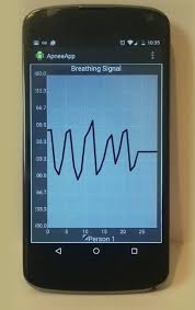 Download the app free today! New Uw App Can Detect Sleep Apnea Events Via Smartphone Uw News