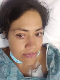 Waiting for my catheter to be removed. Wondering when I would be able to go  swimming