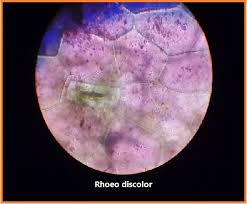 We did not find results for: 30 Ide Keren Gambar Daun Rhoeo Discolor Di Mikroskop Victoria Melani Blog