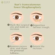 Image result for Blepharis transvaalensis