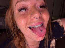 I got metal everywhere at this point.. 😭🤣