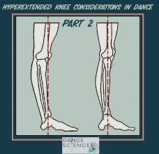 Hyperextended Knees In Dance Pt 2 Hyperextended Knee Dance Knee