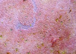 Image result for Microcoelia corallina