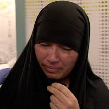 A longa batalha dos médicos para separar irmãs siamesas ligadas pela cabeça 