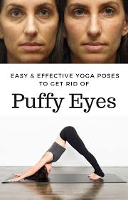 Easy And Effective Yoga Poses To Get Rid Of Puffy Eyes Yoga Poses Puffy Eyes Daily Workout