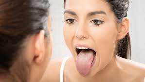 Image result for yellow tongue infection