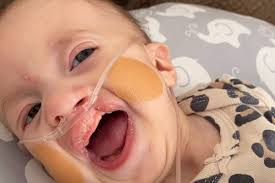 Fundraiser by Kathleen Taylor : Paislee's life saving heart surgery