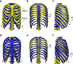 Costae) are the long curved bones which form the rib cage, part of the axial skeleton. Biomechanical Simulation Of Thorax Deformation Using Finite Element Approach Biomedical Engineering Online Full Text