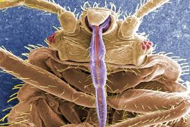 Bed Bug Black Bugs In Hair Pictures Why We Still Have Body Hair Bed Bugs Bed Bug Bites Rid Of Bed Bugs