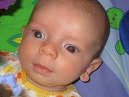 Your child's doctor checks for this at each exam. White Eye Glow In Photos How And When To Act We C Hope