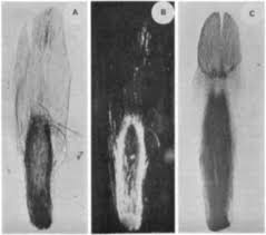 Image result for Helichrysopsis