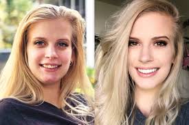 We did not find results for: A New Smile Comes With New Confidence For This Customer Facing Shop Manager The Grin Life