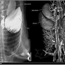 Maybe you would like to learn more about one of these? Simulated X Rays The X Ray Manifestation Of Organs May Be Viewed Download Scientific Diagram