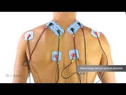 Compex muscle stimulator for neck pain. Compex Electrode Placement Instructional Videos Youtube Compex Muscle Stimulator Compex Muscle Stimulator