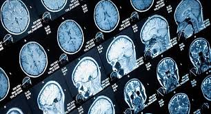 Fizz Ct Scan Ct Scan Machine