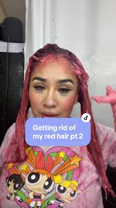 Part 2‼️ let me know of other remedies to try it before my appointment...