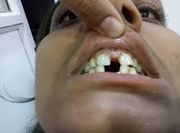 Can my orthodontic treatment be redone at 34?