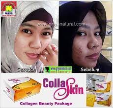 0818 0408 0101 Xl Kulit Wajah Memutihkan Wajah Memutihkan Kulit Cream Wajah Pemutih Wajah Memutihkan Kulit Wajah M Wajah Pencerah Kulit Pemutih Kulit