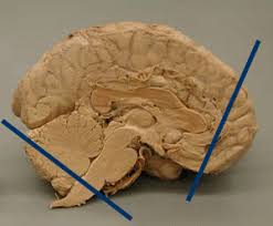 May 27, 2021 · cross sectional anatomy of the brain : A Close Look At The Human Brain