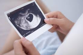 Image result for Ultrasound