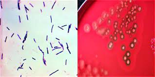 The significance of clostridium spp. Morphology Culture Characteristics Of Clostridium Perfringens